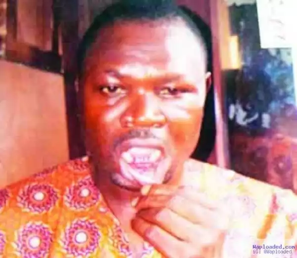 Photo: Man Loses Teeth In Fight With Neighbour Who Peeped At His Wife In Toilet